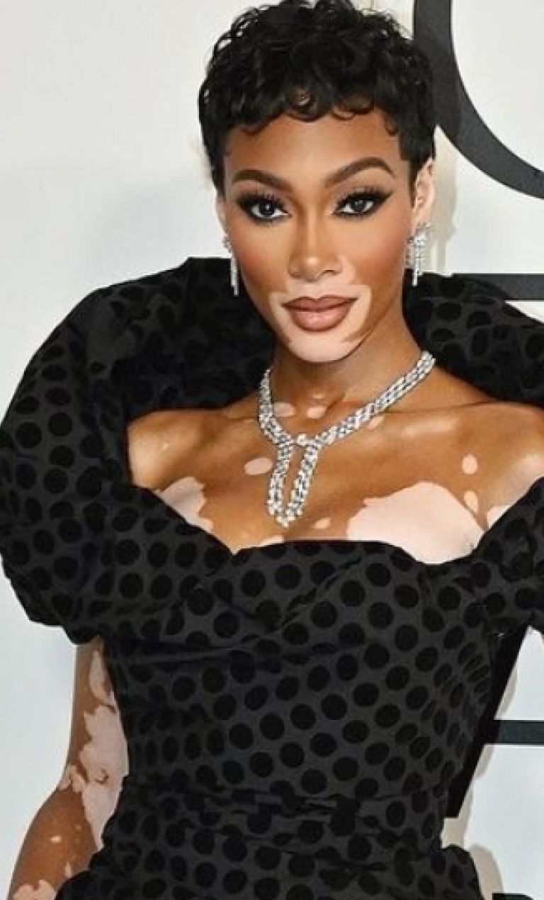 photo by @winnieharlow on Instagram